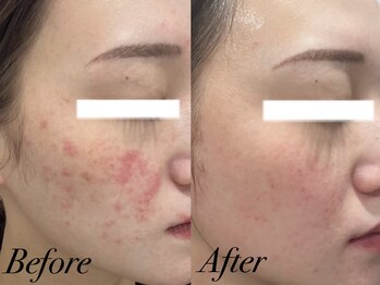 リララ 江坂店(Lelala)/★ビフォーアフター!