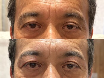 アイブロウサロン アヴィ(A‘VI)/メンズ眉スタイリング