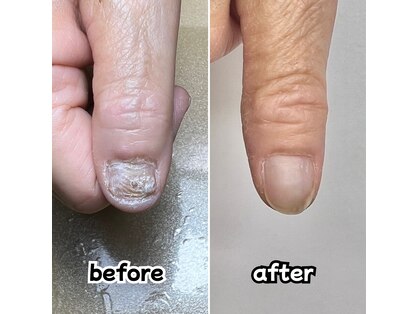 ゴールド(GOLD)の写真