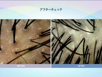 アンス(anth:)/お客様の仕上がり