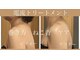 エステスタジオ アキコ(AKIKO)の写真