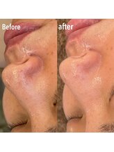 メナードフェイシャルサロン 中萩/