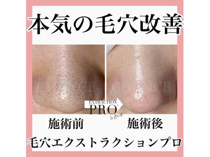 シャンス(CHANCE)の写真
