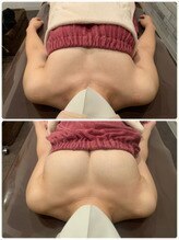 ロココ 岐阜店(Rococo)/☆施術例　Before　After☆