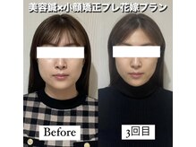 ハリカ 大阪梅田店(HARIKA)/小顔矯正で癖になるスッキリ感を