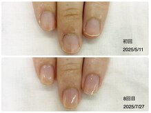 キアラネイル(Chiala nail)/自爪育成
