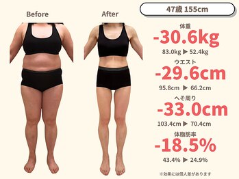 ニドム/47歳　-30kg大幅痩身ダイエット1