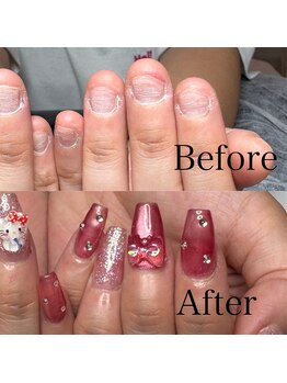 リミズネイルビューティー 名駅店(RimisNailxbeauty)の写真/《都度払いで安心♪他店で断られた方も◎》長さだし10本付★深爪&噛み爪改善¥11000/+アートフリー¥14800!