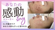 ニキビケア研究所 渋谷店