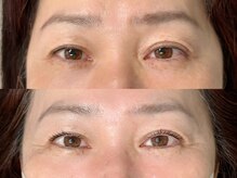 ニーマルイチ(201)/まつげパーマ【DIO CURL】