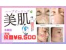 美肌ハーブピーリング体験版【皮むけあり】今月限定価格¥55,000→¥6,500
