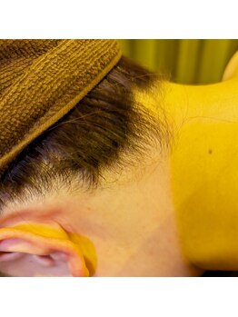 美々庵/LED脱毛*うなじ