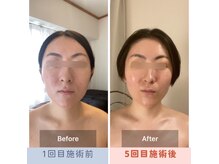 パピヨン(papillon)の雰囲気（状態定着希望の方は目安3週間～1ヵ月間隔がおすすめ☆）