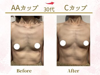 Ms.やまとなでしこ 明石店/ビフォーアフター