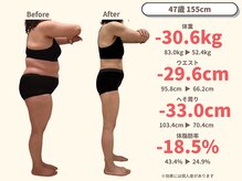 ニドム/47歳　-30kg大幅痩身ダイエット2