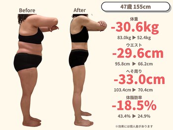 ニドム/47歳　-30kg大幅痩身ダイエット2