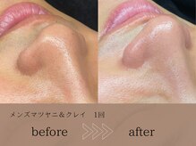 ヴィーヴォ(Vivo)/メンズ　マツヤニ&クレイ