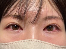 アンネ 東心斎橋店(ANNE)/モンテラッシュリフト