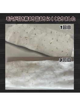 ソワン(soin)/目で見て分かる驚きの結果