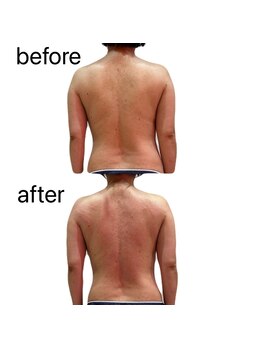 シェリーナ(cherieNa)/美骨 骨盤から背骨を整える