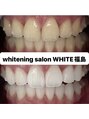 ホワイトニングサロン ホワイト(WHITE)&nbsp;大阪/福島/ホワイトニング/セルフホワイトニング/学割U24/美白