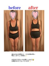 パーソナルビジョン(Personal Vision)/ビフォーアフター