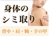 【ボディのシミケア30分やり放題！】（背中・肩・腕・手の甲）他も可♪限定★