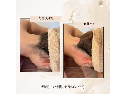 整体 オイルケアサロン かなで(Kanade)の写真