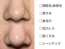 ピュアノア 垂水店/ 産毛脱毛 顔脱毛　神戸垂水明石