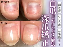 ヴァーチュ(Virtue)の雰囲気（噛み癖、むしり癖による深爪矯正が大人気！剥離もご相談下さい。）