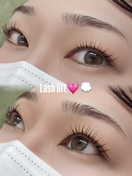 アーラ(Alas)/ラッシュリフト