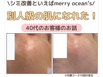 メリーオーシャンズ(merry ocean’s)/シミケア＋肌質改善エステ　