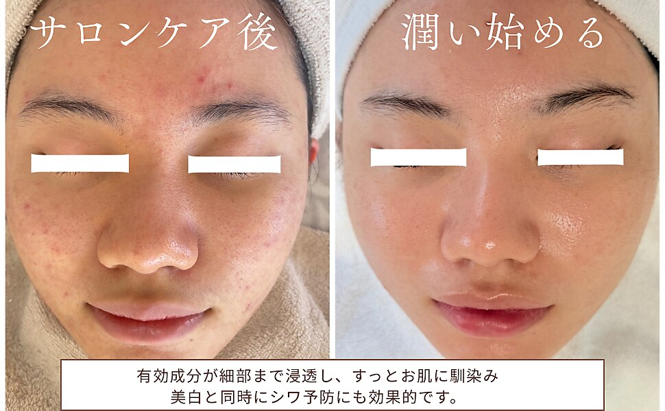 サラシック(salachic)｜ホットペッパービューティー