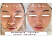 サラシック(salachic)