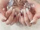 エリナネイルサロン池袋(Alina Nail Salon)の写真/チップ10本長さだし¥8980～◇強度も抜群!韓国パーツなど海外パーツも豊富で抜け感のある手元へ＊池袋駅3分