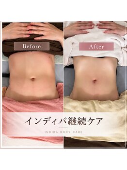 ルルアス(LuLuAS)の写真/インディバの継続ケアで気になるお腹周りもスッキリ！