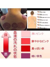 ラブロ(Rabro)/カッピングの痕をみれば…