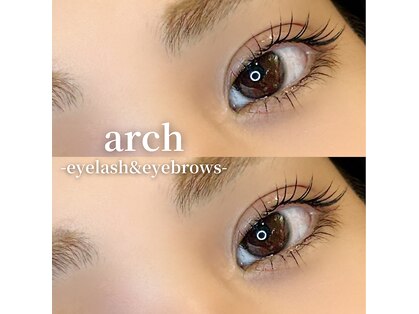 アーチ(arch)の写真