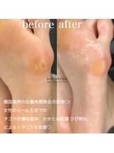 サロン ド ネイル 椿(Salon de nail 椿)/韓国式角質ケアエスプランニング