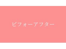 東京G整体/ビフォーアフター