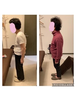 甲陽園鍼灸わたぐも/姿勢改善