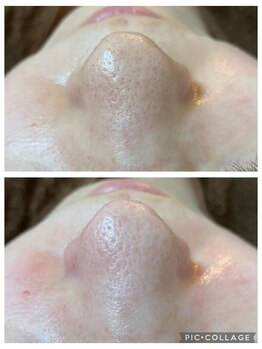 ドリーム(dRe:am)/新メニュー☆毛穴ケア