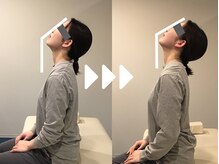 ミライズ整体院 三宮駅前院/事例【20代女性・首こり】