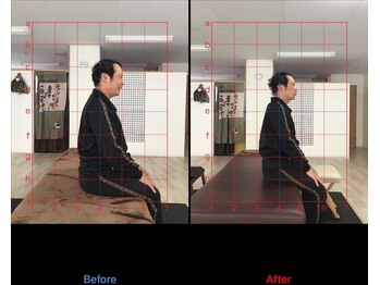 ストレチックス 近江八幡店/BeforeAfter