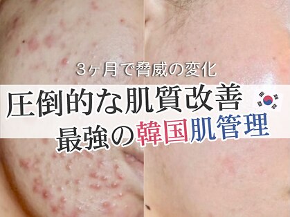 カンナムビューティーの写真