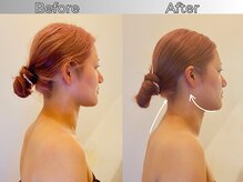 リストアハート(Restore Heart)/横顔美人＝小顔印象を決める“