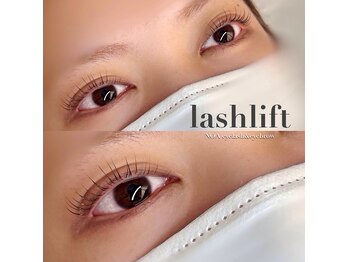 ノア(NOA)/美容液で美まつげを☆