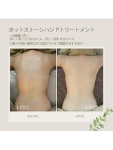 リラ(Lilas)/回数を重ねると見違える背中