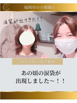 顔凛(カオリン)/50代あの頃の涙袋出現