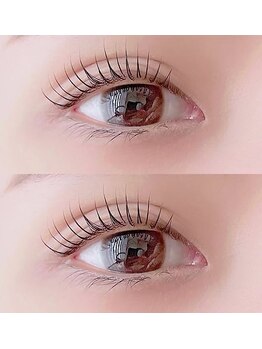 rutileの写真/まぶたの重み/眼精疲労に特化！【極上アイケア×まつげパーマ】でパッチリ開く若々しい目元へ☆